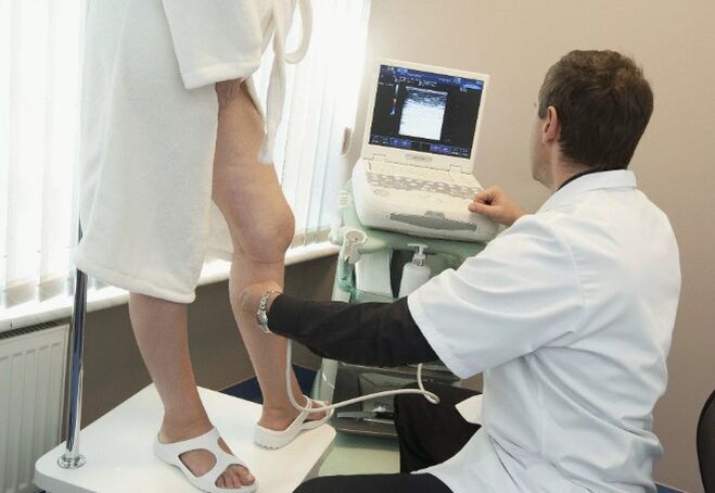 Diagnostika kŕčových žíl